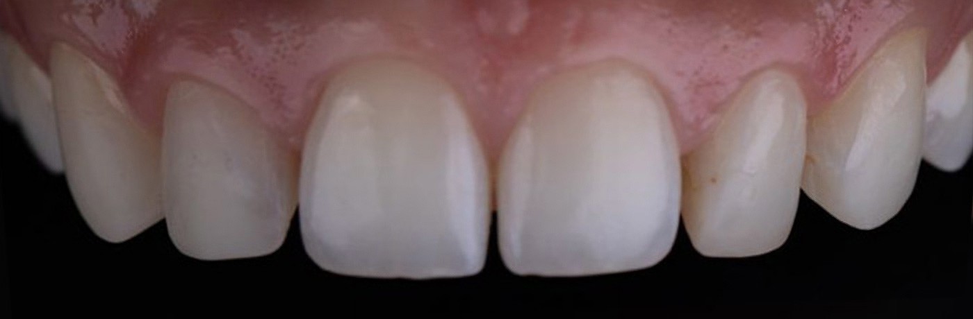 02-before